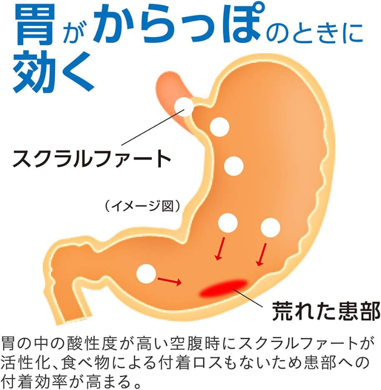 日本LION獅王sucrate修復腸胃藥錠劑 102錠:圖片 6